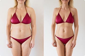 PeakBioMe Everlean Benefit