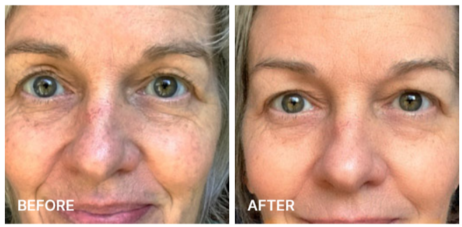 South Beach SkinLab Repair & Release Cream Benefits 